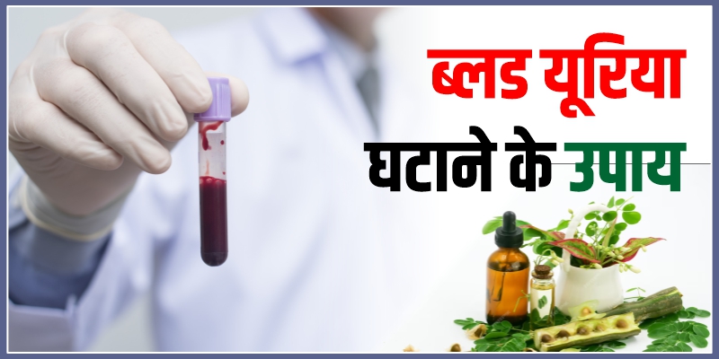 ब्लड-यूरिया-घटाने-के-उपाय